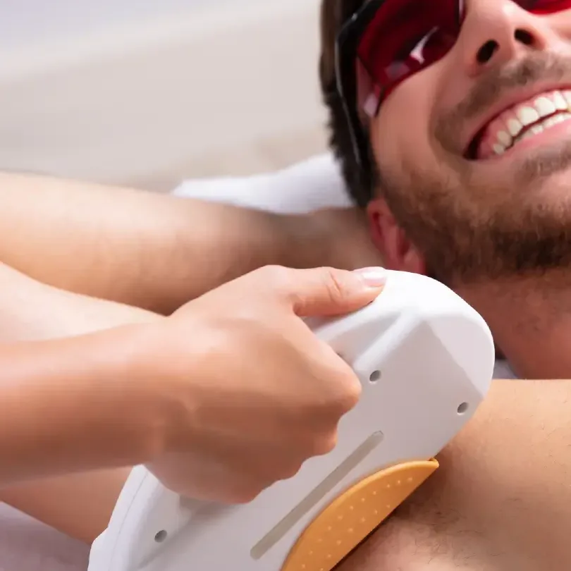 Épilation laser diode des aisselles chez un homme, lunettes de protection