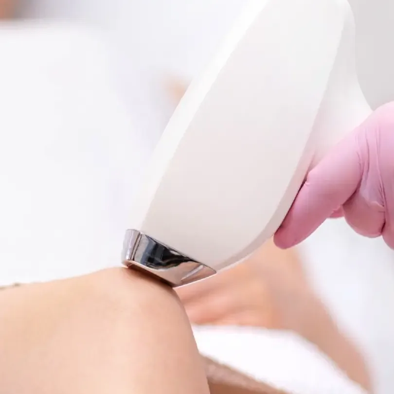 Épilation laser diode : pièce à main sur la jambe