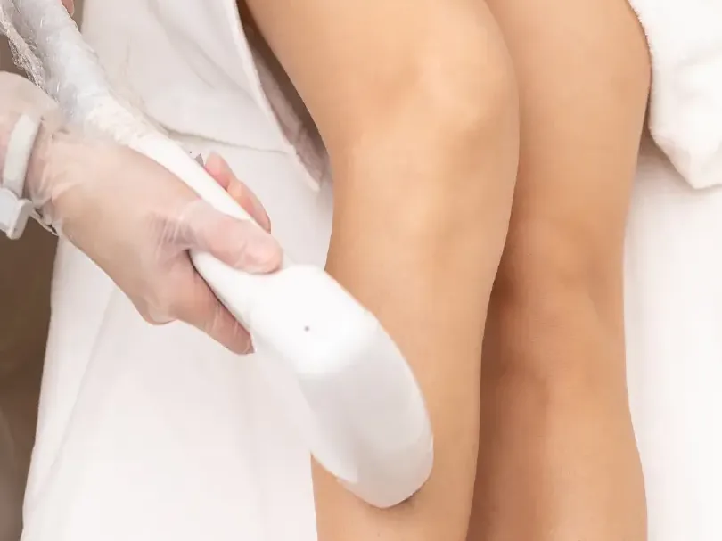 Épilation laser diode des jambes : passage de la pièce à main